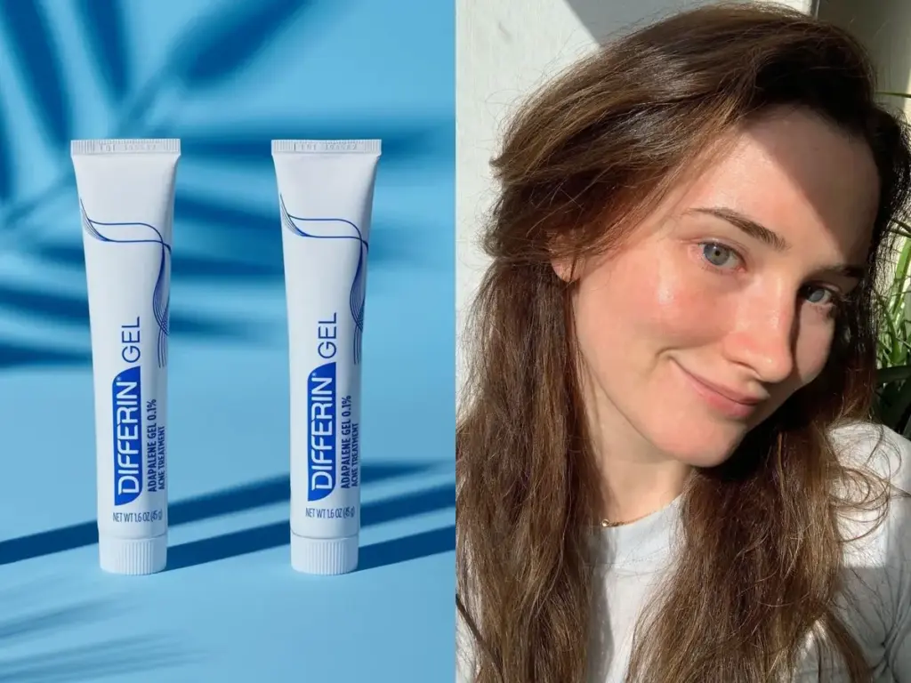 Effective Differin Spot Treatment Techniques Explained