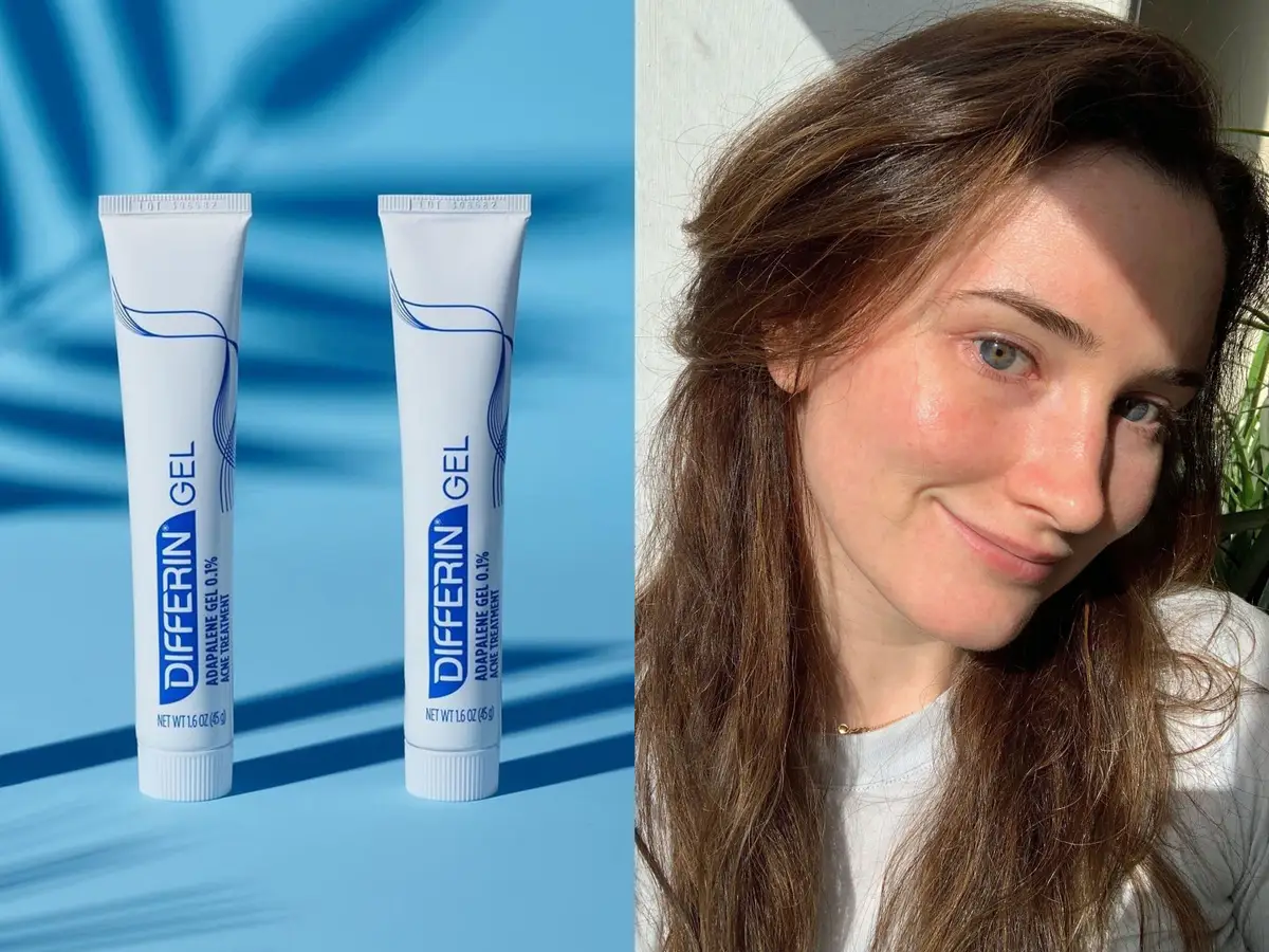 Effective Differin Spot Treatment Techniques Explained